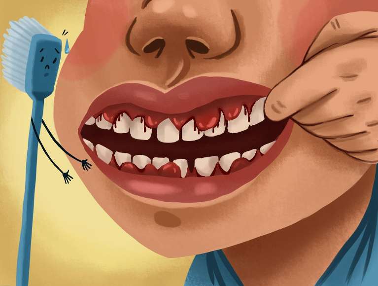 Illustration of boy with bleeding gums due to gum disease next to a toothbrush reaching out to help