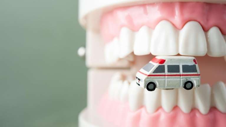 model of teeth with an ambulance, dental emergencies