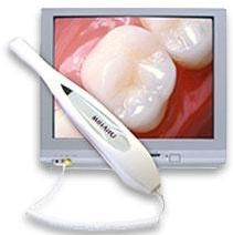 intra-oral camera